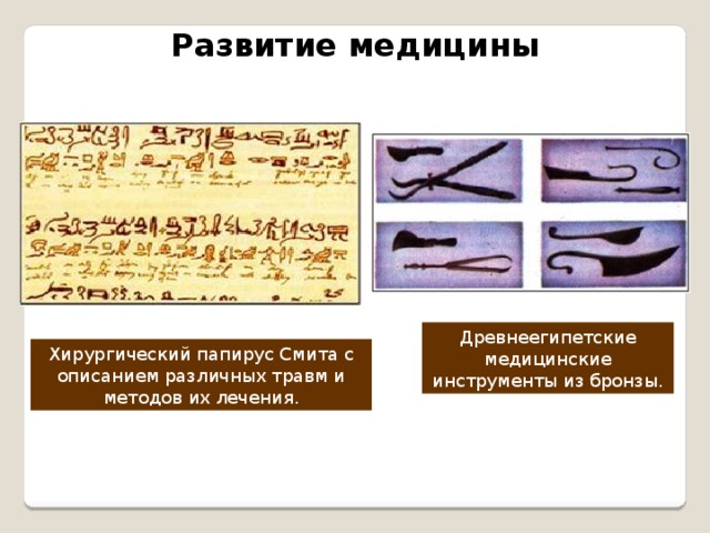 Развитие медицины Древнеегипетские медицинские инструменты из бронзы. Хирургический папирус Смита с описанием различных травм и методов их лечения.