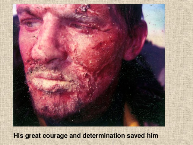 His great courage and determination saved him