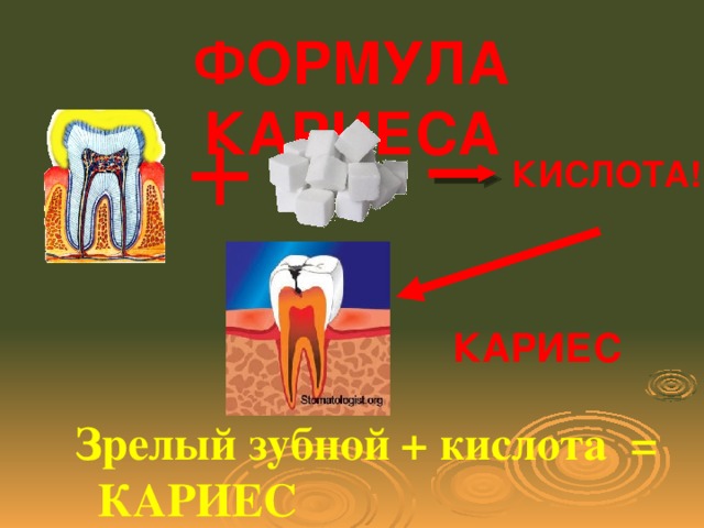 ФОРМУЛА КАРИЕСА КИСЛОТА! КАРИЕС Зрелый зубной + кислота = КАРИЕС