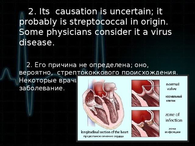 2. Its causation is uncertain; it probably is streptococcal in origin. Some physicians consider it a virus disease.  2. Его причина не определена; оно, вероятно, стрептококкового происхождения. Некоторые врачи считают что это вирусное заболевание.