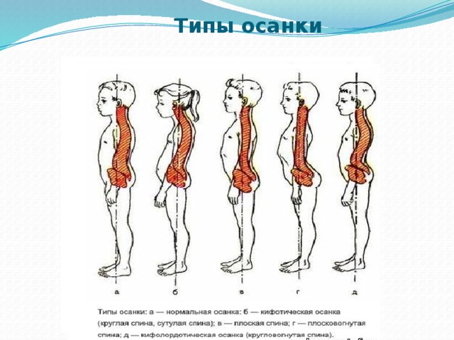 Какие основные требования к правильной осанке должны соблюдаться при работе за компьютером с точки