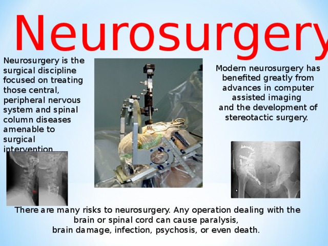 Neurosurgery  Neurosurgery is the surgical discipline focused on treating those central, peripheral nervous system and spinal column diseases amenable to surgical intervention. Modern neurosurgery has benefited greatly  from advances in computer assisted imaging and the development of stereotactic surgery. There are many risks to neurosurgery. Any operation dealing with the brain or  spinal cord can cause paralysis, brain damage, infection, psychosis, or even death.