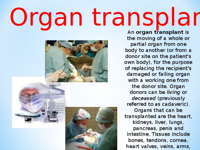 Organ transplant An organ transplant is the moving of a whole or partial organ from one body to another (or from a donor site on the patient's own body), for the purpose of replacing the recipient's damaged or failing organ with a working one from the donor site. Organ donors can be living or deceased (previously referred to as cadaveric). Organs that can be transplanted are the heart, kidneys, liver, lungs, pancreas, penis and intestine. Tissues include bones, tendons, cornea, heart valves, veins, arms, and skin.