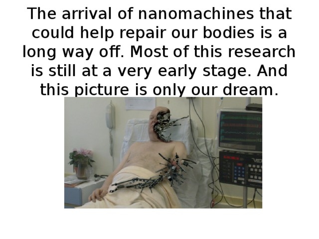 The arrival of nanomachines that could help repair our bodies is a long way off. Most of this research is still at a very early stage. And this picture is only our dream.