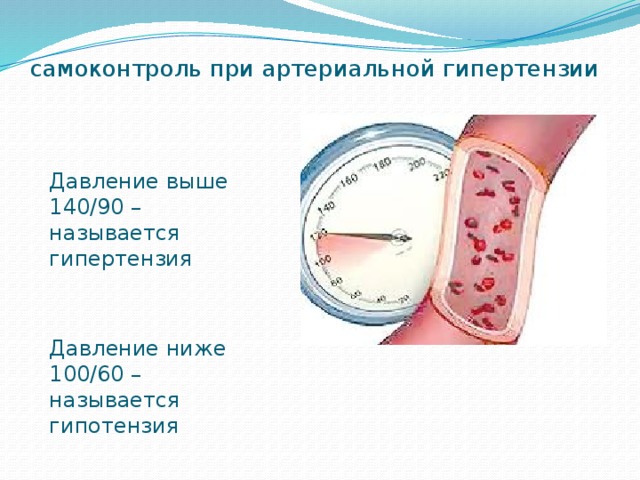 самоконтроль при артериальной гипертензии Давление выше 140/90 – называется гипертензия Давление ниже 100/60 – называется гипотензия