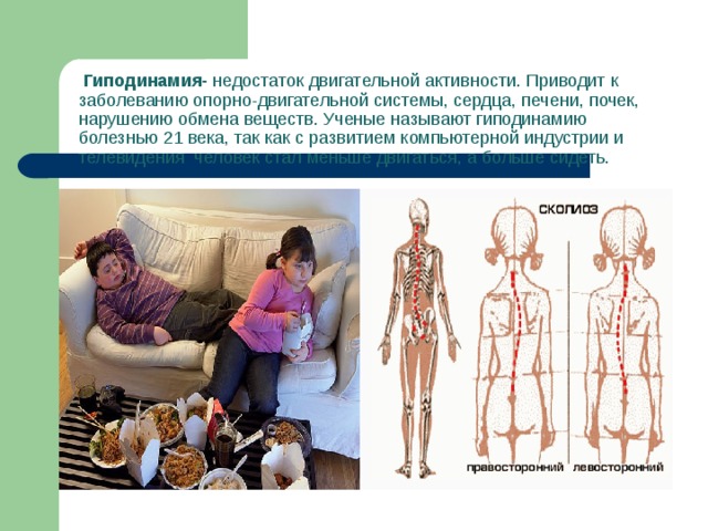 Гиподинамия- недостаток двигательной активности. Приводит к заболеванию опорно-двигательной системы, сердца, печени, почек, нарушению обмена веществ. Ученые называют гиподинамию болезнью 21 века, так как с развитием компьютерной индустрии и телевидения человек стал меньше двигаться, а больше сидеть.