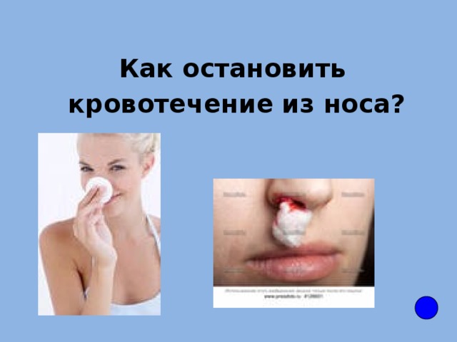 Как остановить  кровотечение из носа?