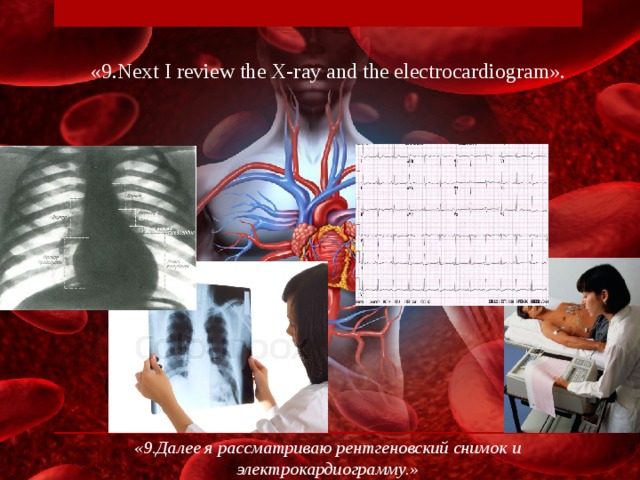 «9.Next I review the X-ray and the electrocardiogram». «9.Далее я рассматриваю рентгеновский снимок и электрокардиограмму.»