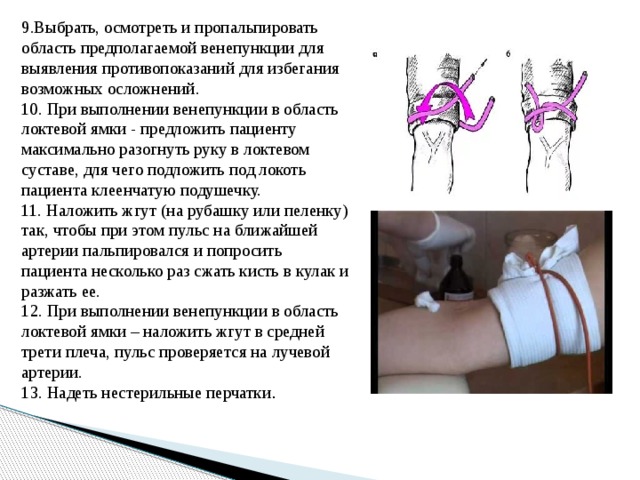 9.Выбрать, осмотреть и пропальпировать область предполагаемой венепункции для выявления противопоказаний для избегания возможных осложнений. 10. При выполнении венепункции в область локтевой ямки - предложить пациенту максимально разогнуть руку в локтевом суставе, для чего подложить под локоть пациента клеенчатую подушечку. 11. Наложить жгут (на рубашку или пеленку) так, чтобы при этом пульс на ближайшей артерии пальпировался и попросить пациента несколько раз сжать кисть в кулак и разжать ее. 12. При выполнении венепункции в область локтевой ямки – наложить жгут в средней трети плеча, пульс проверяется на лучевой артерии. 13. Надеть нестерильные перчатки .