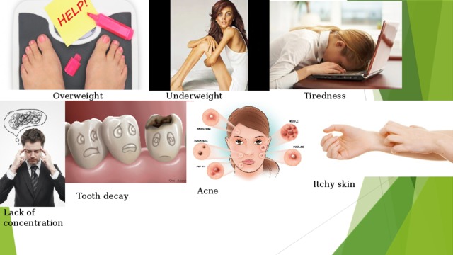 Tiredness Underweight Overweight Itchy skin Acne Tooth decay Lack of concentration