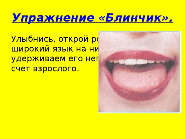 Упражнение «Блинчик». Улыбнись, открой рот, положи широкий язык на нижнюю губу и удерживаем его неподвижно под счет взрослого.