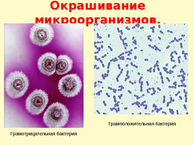 Окрашивание микроорганизмов. Грамположительная бактерия Грамотрицательная бактерия