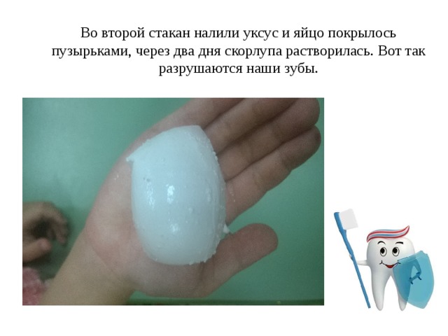Во второй стакан налили уксус и яйцо покрылось пузырьками, через два дня скорлупа растворилась. Вот так разрушаются наши зубы.