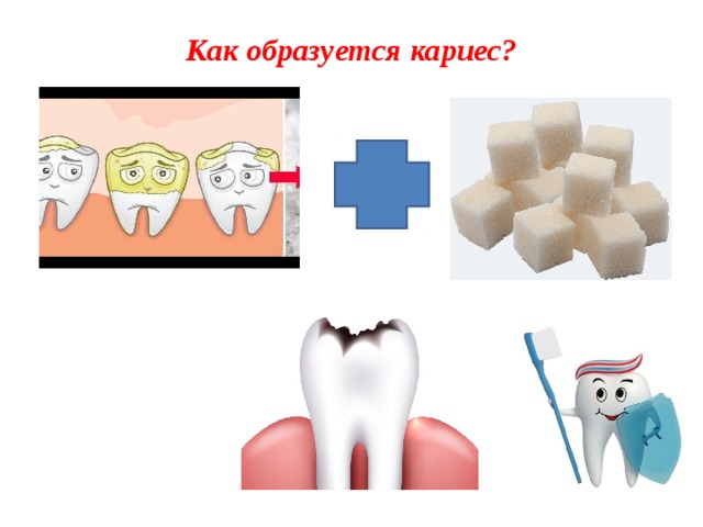 Как образуется кариес?