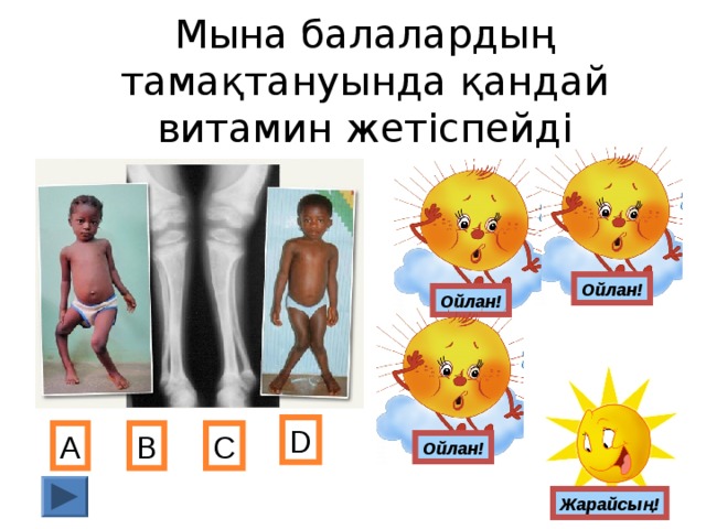 Мына балалардың тамақтануында қандай витамин жетіспейді Ойлан! Ойлан! D А В С Ойлан! Жарайсың!