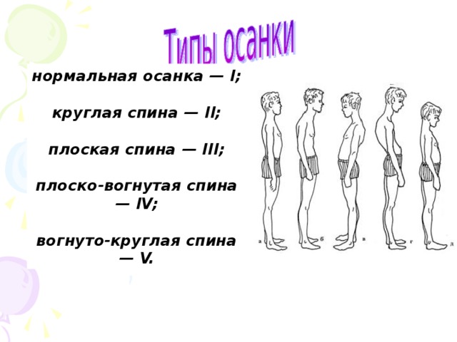 нормальная осанка — I;  круглая спина — II;  плоская спина — III;  плоско-вогнутая спина — IV;  вогнуто-круглая спина — V.