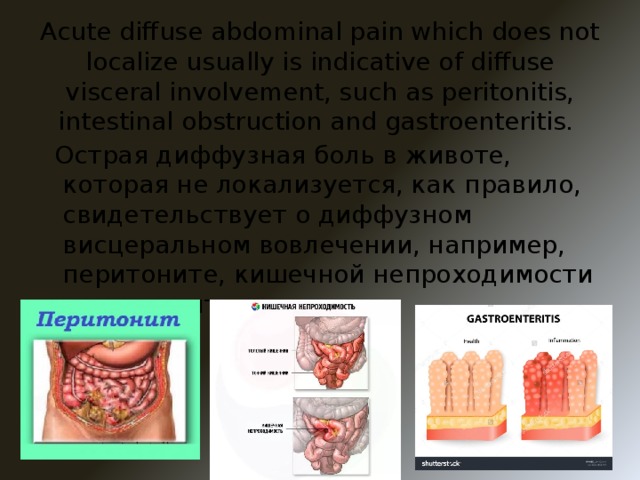 Acute diffuse abdominal pain which does not localize usually is indicative of diffuse visceral involvement, such as peritonitis, intestinal obstruction and gastroenteritis.  Острая диффузная боль в животе, которая не локализуется, как правило, свидетельствует о диффузном висцеральном вовлечении, например, перитоните, кишечной непроходимости и гастроэнтерите.
