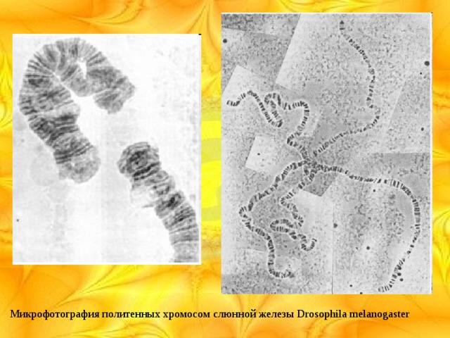 Микрофотография политенных хромосом слюнной железы Drosophila melanogaster