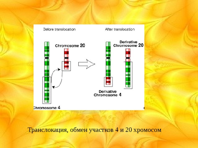 Транслокация, обмен участков 4 и 20 хромосом