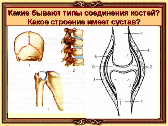 Какие бывают типы соединения костей?  Какое строение имеет сустав?