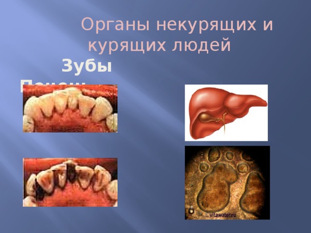 Органы некурящих и курящих людей  Зубы Печень