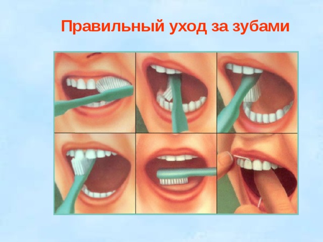 Правильный уход за зубами