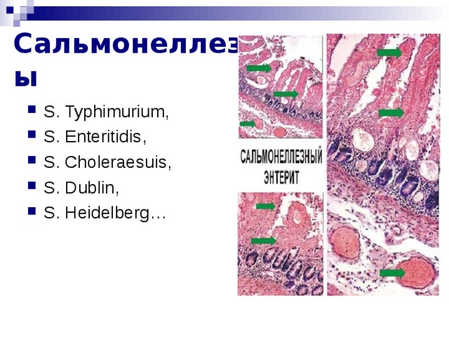 Сальмонеллезы S . Typhimurium , S . Enteritidis , S . Choleraesuis , S . Dublin , S . Heidelberg … zzzzzzzzzzzzzzzzzzzzzzzzzzzzzzzzzzzz