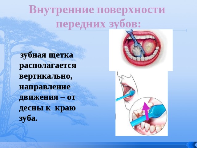 Внутренние поверхности передних зубов:  зубная щетка располагается вертикально, направление движения – от десны к краю зуба.