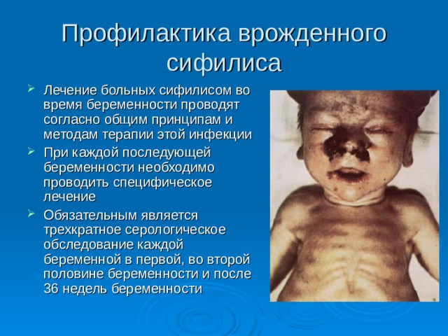 Профилактика врожденного сифилиса