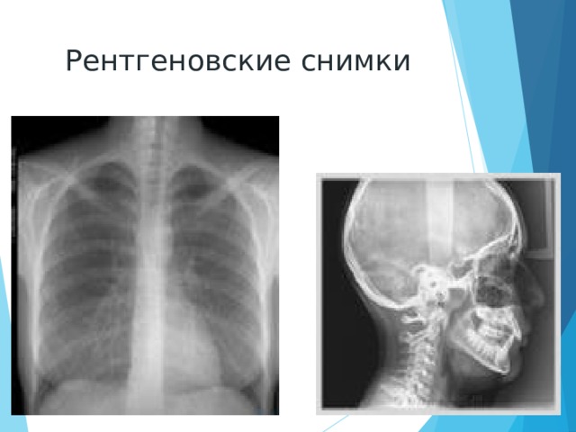 Рентгеновские снимки
