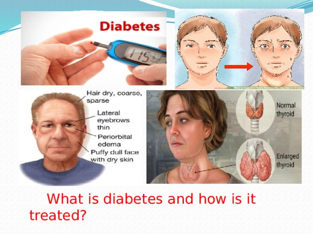 What is diabetes and how is it treated?