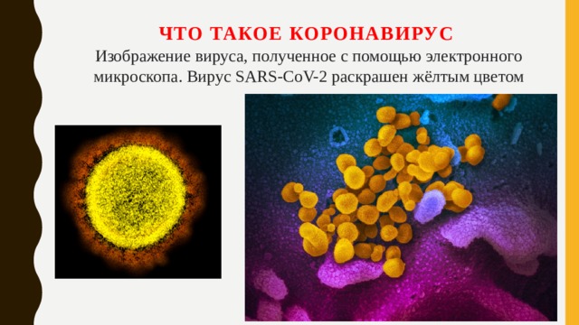 Что такое коронавирус Изображение вируса, полученное с помощью электронного микроскопа. Вирус SARS-CoV-2 раскрашен жёлтым цветом
