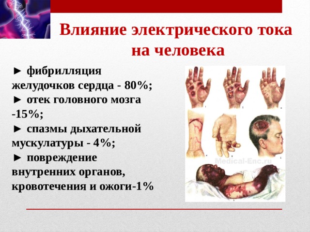 Влияние электрического тока  на человека ► фибрилляция желудочков сердца - 80%; ► отек головного мозга -15%; ► спазмы дыхательной мускулатуры - 4%; ► повреждение внутренних органов, кровотечения и ожоги-1%