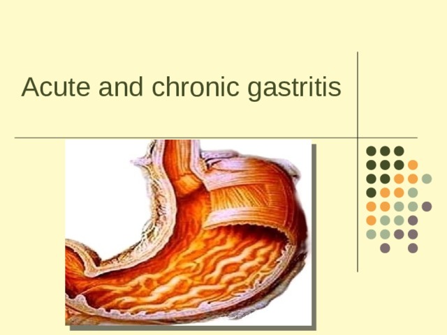 Acute and chronic gastritis