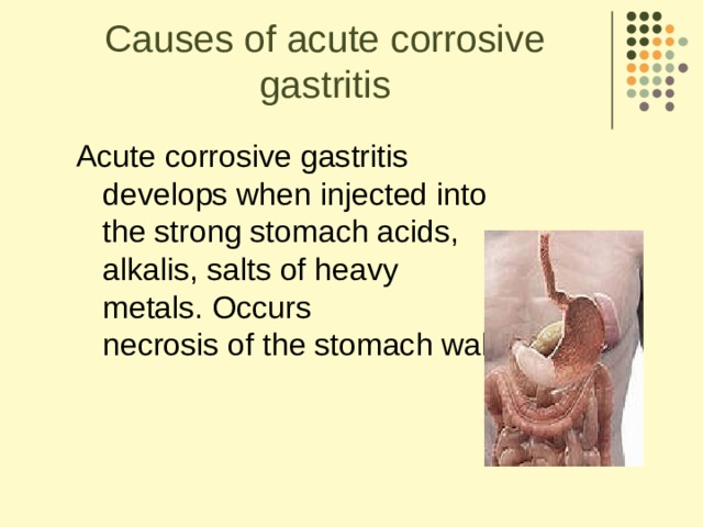 Causes of acute corrosive gastritis Acute corrosive gastritis   develops when injected into   the strong stomach acids,  alkalis, salts of heavy  metals. Occurs   necrosis of the stomach wall.