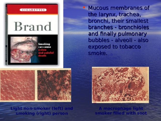 Mucous membranes of the larynx, trachea, bronchi, their smallest branches - bronchioles and finally pulmonary bubbles - alveoli - also exposed to tobacco smoke .