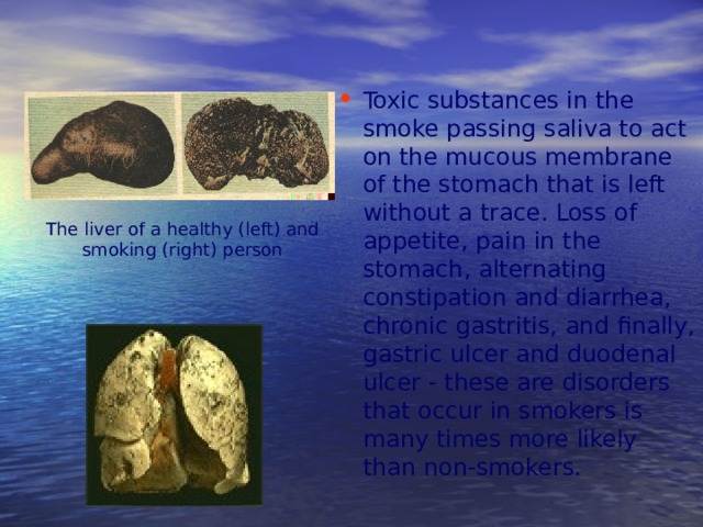 Toxic substances in the smoke passing saliva to act on the mucous membrane of the stomach that is left without a trace. Loss of appetite, pain in the stomach, alternating constipation and diarrhea, chronic gastritis, and finally, gastric ulcer and duodenal ulcer - these are disorders that occur in smokers is many times more likely than non-smokers.
