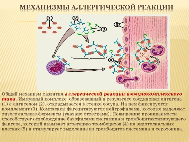 Общий механизм развития аллергической реакции иммунокомплексного типа. Иммунный комплекс, образованный в результате соединения антигена (1) с антителом (2), откладывается в стенке сосуда. На нем фиксируется комплемент (3). Комплексы фагоцитируются нейтрофилами, которые выделяют лизосомальные ферменты (указано стрелками). Повышению проницаемости способствует освобождение базофилами гистамина и тромбоцитактивирующего фактора, который вызывает агрегацию тромбоцитов (4) на эндотелиальных клетках (5) и стимулирует выделение из тромбоцитов гистамина и серотонина.