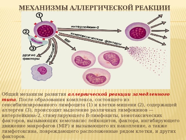Общий механизм развития аллергической реакции замедленного типа . После образования комплекса, состоящего из сенсибилизированного лимфоцита (1) и клетки-мишени (2), содержащей аллерген (3), происходит выделение различных лимфокинов — интерлейкина-2, стимулирующего В-лимфоциты, хемотаксических факторов, вызывающих хемотаксис лейкоцитов, фактора, ингибирующего движение макрофагов (MIF) и вызывающего их накопление, а также лимфотоксина, повреждающего расположенные рядом клетки, и других факторов.