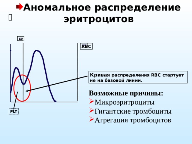 Аномальное распределение эритроцитов LD LD RBC RBC Кривая распределения RBC стартует не на базовой линии . Возможные причины: Микроэритроциты Гигантские тромбоциты Агрегация тромбоцитов