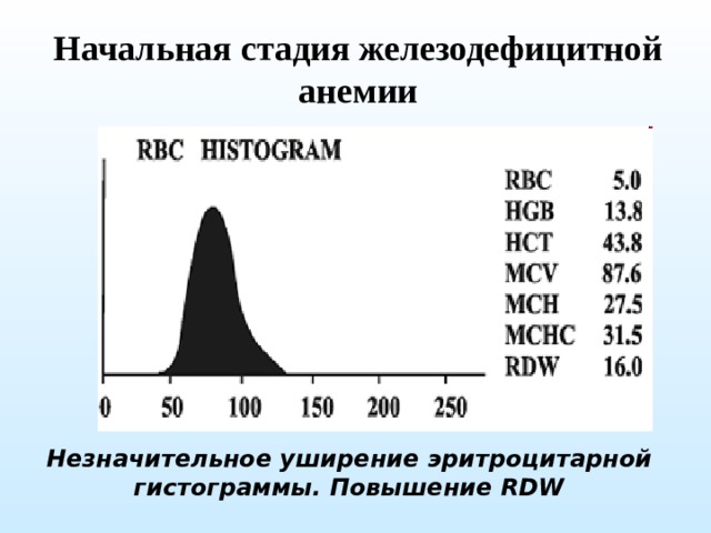 Начальная стадия железодефицитной анемии Незначительное уширение эритроцитарной гистограммы. Повышение RDW