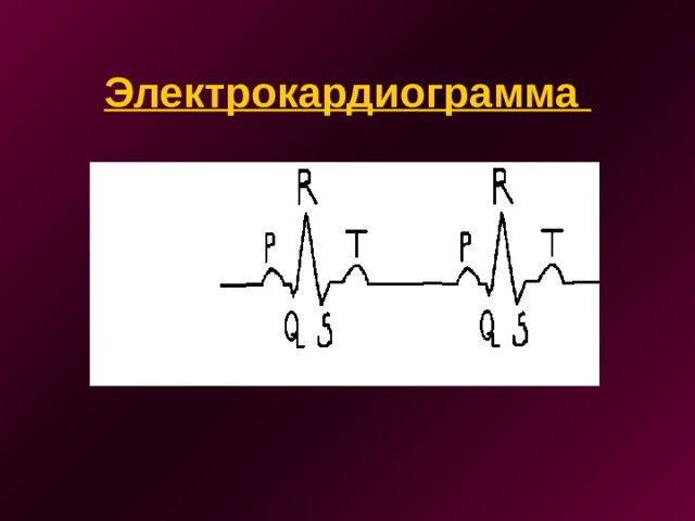 Электрокардиограмма