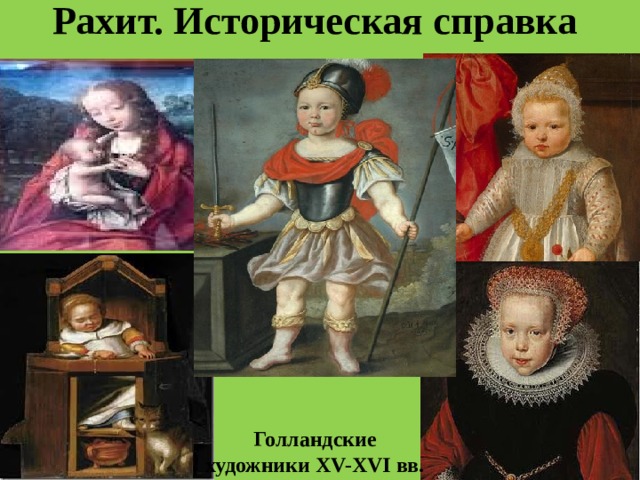 Рахит. Историческая справка   Голландские художники XV-XVI вв.