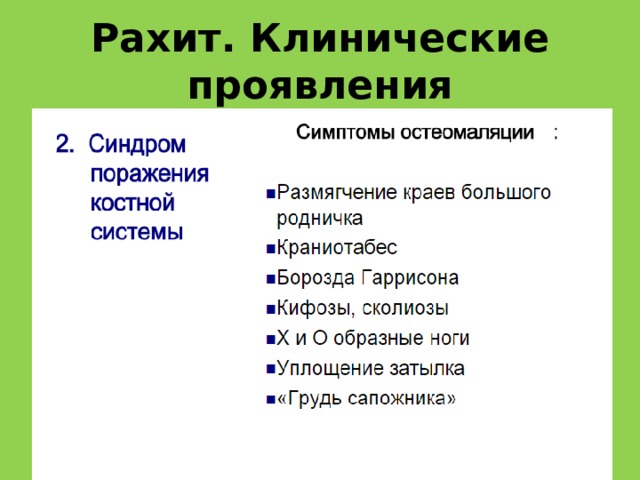 Рахит. Клинические проявления