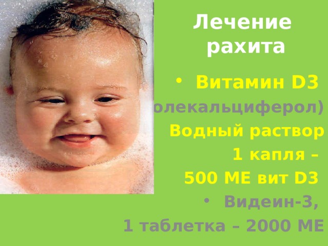 Лечение  рахита Витамин D 3  (Холекальциферол) Водный раствор 1 капля – 500 МЕ вит D 3 Видеин-3, 1 таблетка – 2000 МЕ