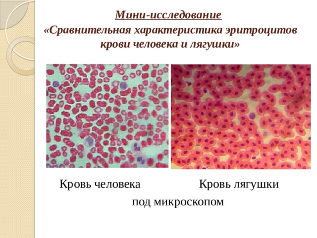 Мини-исследование   «Сравнительная характеристика эритроцитов крови человека и лягушки»  Кровь человека Кровь лягушки под микроскопом