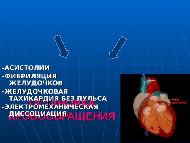 -АСИСТОЛИИ -ФИБРИЛЯЦИЯ ЖЕЛУДОЧКОВ -ЖЕЛУДОЧКОВАЯ ТАХИКАРДИЯ БЕЗ ПУЛЬСА - ЭЛЕКТРОМЕХАНИЧЕСКАЯ ДИССОЦИАЦИЯ  ОСТАНОВКА КРОВООБРАЩЕНИЯ СЕРДЕЧНЫЕ ПРИЧИНЫ ВНЕСЕРДЕЧНЫЕ ПРИЧИНЫ