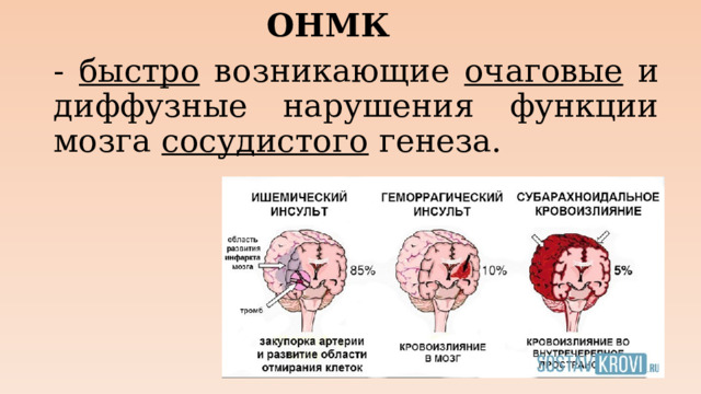 ОНМК - быстро возникающие очаговые и диффузные нарушения функции мозга сосудистого генеза.