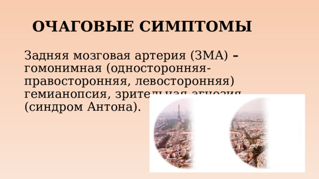 ОЧАГОВЫЕ СИМПТОМЫ Задняя мозговая артерия (ЗМА) – гомонимная (односторонняя- правосторонняя, левосторонняя) гемианопсия, зрительная агнозия (синдром Антона).