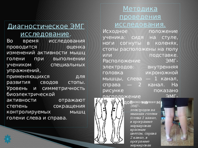 Методика проведения исследования. Исходное положение ученика: сидя на стуле, ноги согнуты в ко­ленях, стопы расположены на полу или подставке. Расположение ЭМГ-электродов: внутренняя головка икроножной мышцы, слева — 1 канал, справа — 2 канал. На рисунке показано расположение ЭМГ-электродов на мышцах голени. Диагностическое ЭМГ исследование . Во время исследования проводится оценка изменений активно­сти мышц голени при выполнении учеником специальных упражне­ний, применяющихся для развития сводов стопы. Уровень и симме­тричность биоэлектрической активности отражают степень сокра­щения контролируемых мышц голени слева и справа. Расположение ЭМГ-электродов на мышцах голени (слева 1 канал, в программе маркирован красным цветом, справа 2 канал, в программе маркирован зелёным цветом).